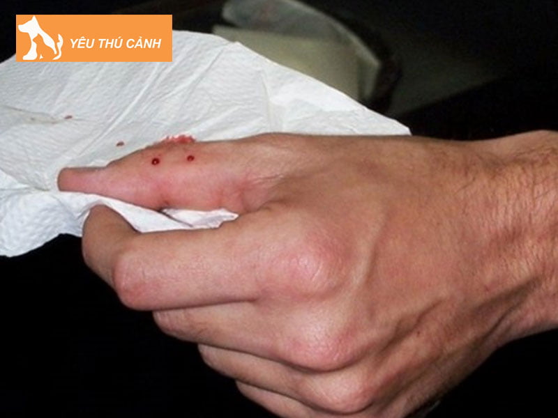 cach-xu-ly-khi-bi-ret-can-thucanh