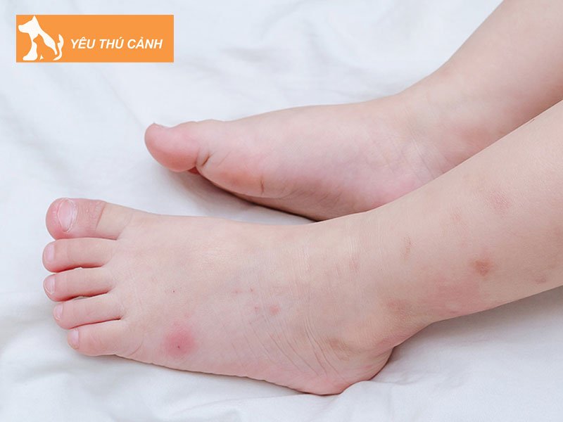 nhung-cach-tri-ran-meo-can-thucanh