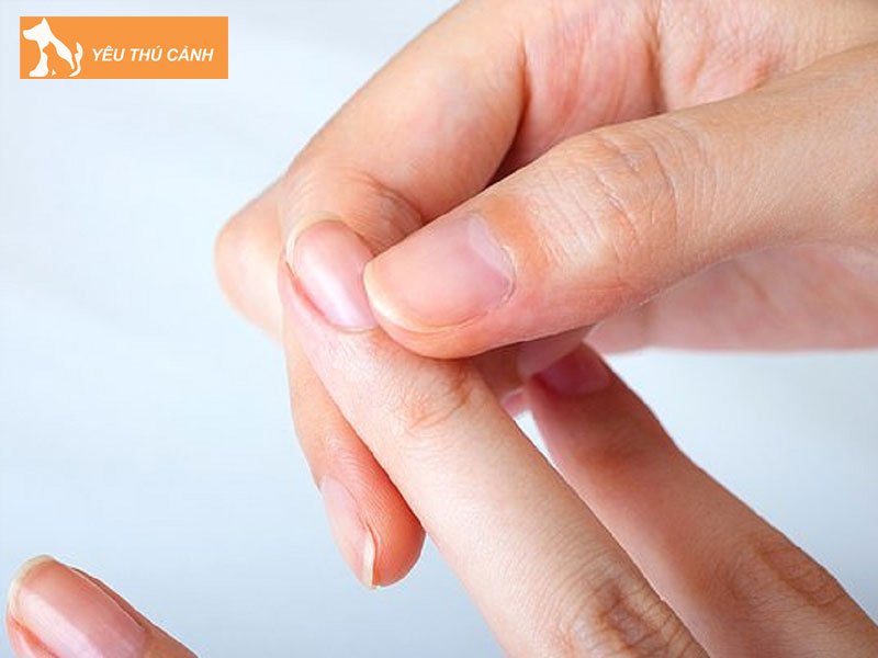 tuong-mong-tay-nguoi-co-phuc-thucanh