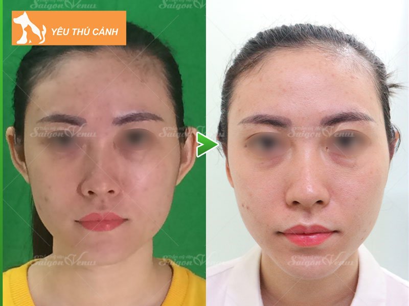 tuong-tai-venh-o-nam-nu-noi-len-dieu-gi-thucanh